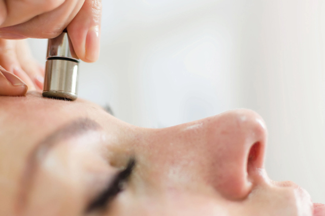 Microdermabrasion